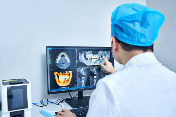 Best Emergency Wisdom Teeth Removal in Austin, TX