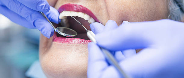 Best Emergency Gum Treatment in Austin, TX